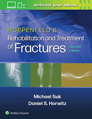 Hoppenfeld's Treatment and Rehabilitation of Fractures, Second edition