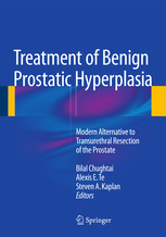 Treatment of Benign Prostatic Hyperplasia: Modern Alternative to Transurethral Resection of the Prostate