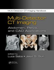 Multi-Detector CT Imaging: Abdomen, Pelvis, and CAD Applications