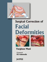 Surgical Correction of Facial Deformities