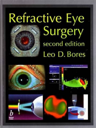 Refractive Eye Surgery 2nd edition