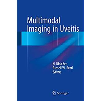 Multimodal Imaging in Uveitis