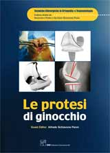 Le Protesi di Ginocchio