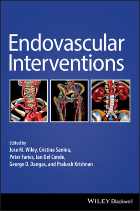 Endovascular Interventions