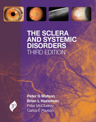 The Sclera and Systemic Disorders, 3rd Edition