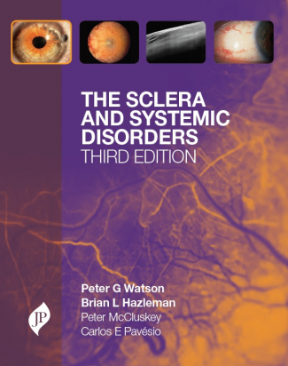 The Sclera and Systemic Disorders, 3rd Edition