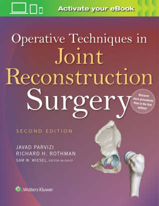 Operative Techniques in Joint Reconstruction Surgery 2nd ed