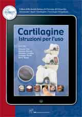 Cartilagine