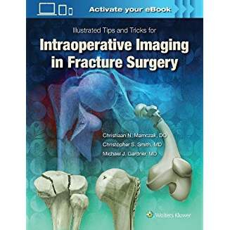 Illustrated Tips and Tricks for Intraoperative Imaging in Fracture Surgery, 1e 