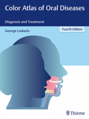 Color Atlas of Oral Diseases 4th ed