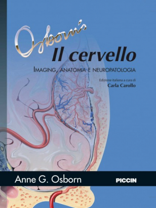 Il cervello