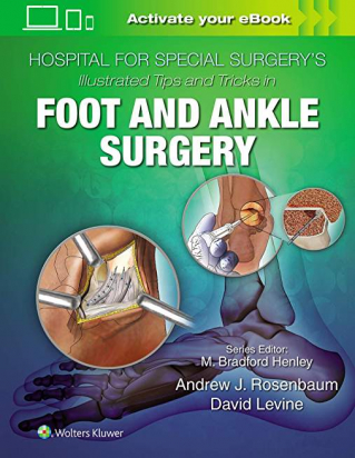 Hospital for Special Surgery's Illustrated Tips and Tricks in Foot and Ankle Surgery First edition