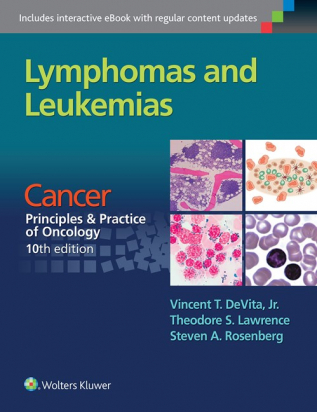 Lymphomas and Leukemias