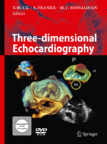 Three-dimensional Echocardiography