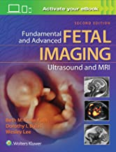 Fundamental and Advanced Fetal Imaging Ultrasound and MRI Second edition