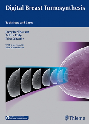 Digital Breast Tomosynthesis