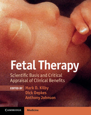 Fetal Therapy -  Scientific Basis and Critical Appraisal of Clinical Benefits