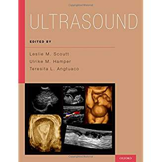 Ultrasound