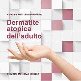 Dermatite atopica dell'adulto