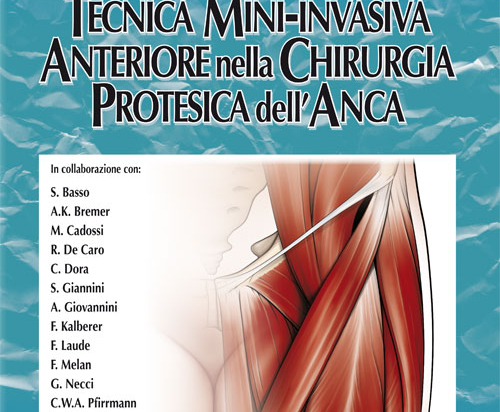 La Tecnica Mini-Invasiva Anteriore nella Chirurgia Protesica dell'Anca