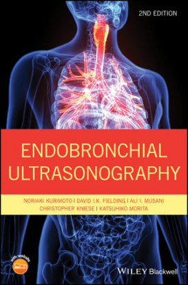 Endobronchial Ultrasonography, 2nd Edition