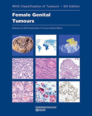 WHO Classification of Tumours: Female Genital Tumours