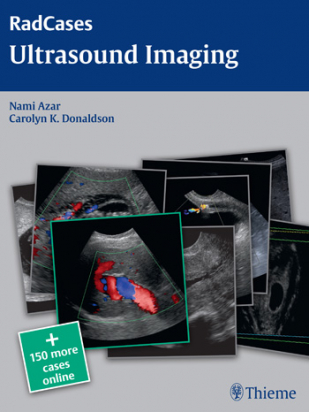 Ultrasound Imaging 1st ed