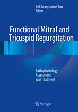 Functional Mitral and Tricuspid Regurgitation