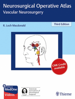 Neurosurgical Operative Atlas: Vascular Neurosurgery