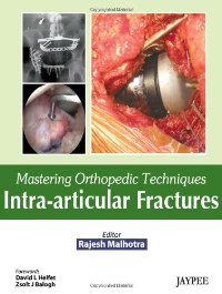Mastering Orthopedic Techniques: Intra-Articular Fractures