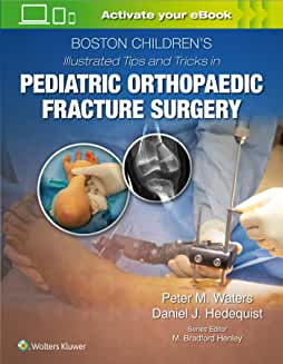 Boston Children’s Illustrated Tips and Tricks in Pediatric Orthopaedic Fracture Surgery