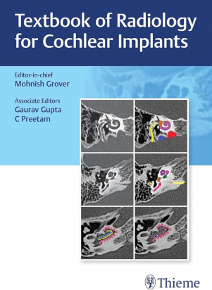 Textbook of Radiology for Cochlear Implants