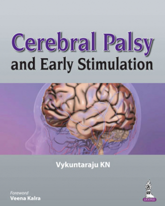 Cerebral Palsy and Early Stimulation