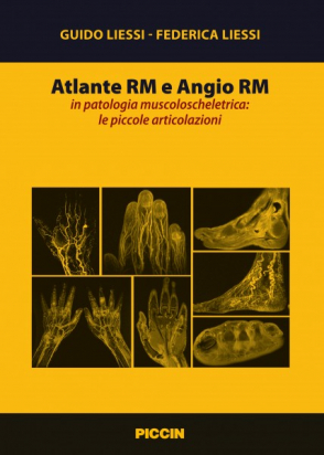 Atlante Rm e Angio Rm in Patologia Muscoloscheletrica: le Piccole Articolazioni