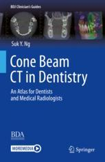 Cone Beam CT in Dentistry