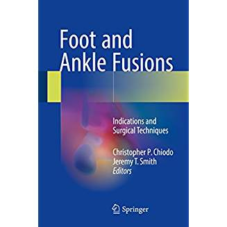 Foot and Ankle Fusions