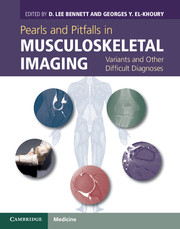 Pearls and Pitfalls in Musculoskeletal Imaging - Variants and Other Difficult Diagnoses