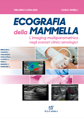 Ecografia della Mammella