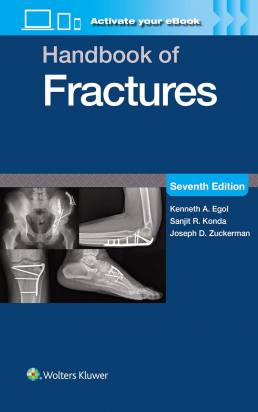 Handbook of Fractures, Seventh edition