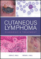 Cutaneous Lymphoma