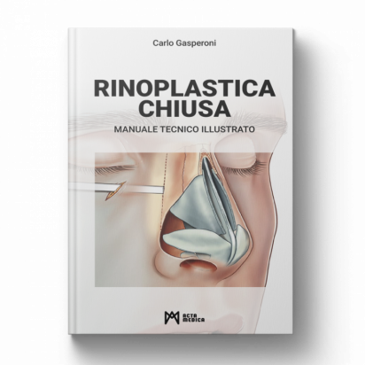 Rinoplastica chiusa – Manuale tecnico illustrato