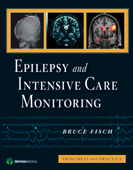 Epilepsy and Intensive Care Monitoring