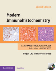 Modern Immunohistochemistry - 2nd Edition