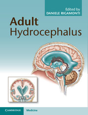 Adult Hydrocephalus