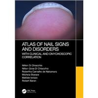 Atlas of Nail Signs and Disorders with Clinical and Onychoscopic Correlation