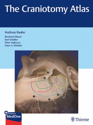 The Craniotomy Atlas 