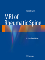 MRI of Rheumatic Spine