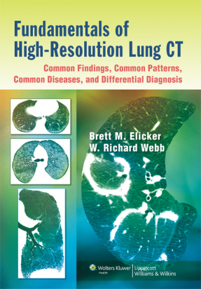 Fundamentals of High-Resolution Lung CT: Common Findings, Common Patterns, Common Diseases, and Differential Diagnosis