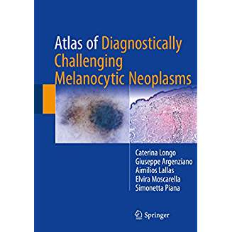 Atlas of Diagnostically Challenging Melanocytic Neoplasms