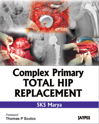 Complex Primary Total Hip Replacement